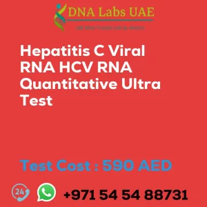 Hepatitis C Viral RNA HCV RNA Quantitative Ultra Test sale cost 590 AED