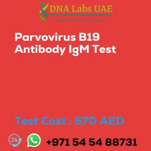 Parvovirus B19 Antibody IgM Test sale cost 570 AED