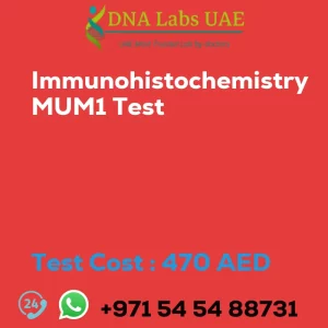 Immunohistochemistry MUM1 Test sale cost 470 AED