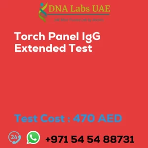 Torch Panel IgG Extended Test sale cost 470 AED