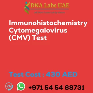 Immunohistochemistry Cytomegalovirus (CMV) Test sale cost 430 AED