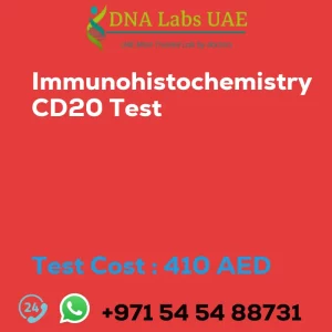 Immunohistochemistry CD20 Test sale cost 410 AED