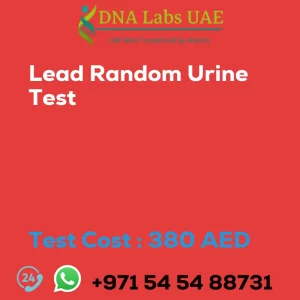 Lead Random Urine Test sale cost 380 AED