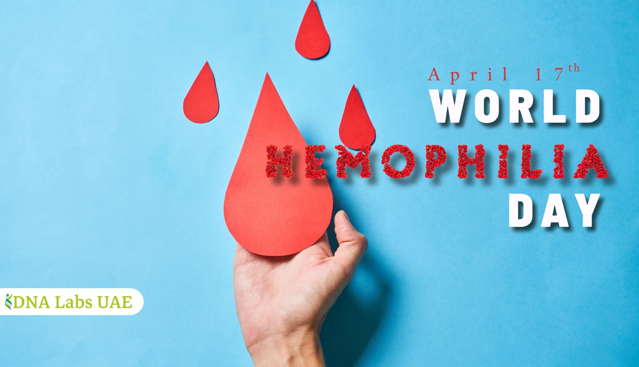 Hand holding a large red blood drop cutout with smaller drops above, on a blue background, alongside text “April 17th World Hemophilia Day.”