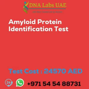 Amyloid Protein Identification Test sale cost 24570 AED