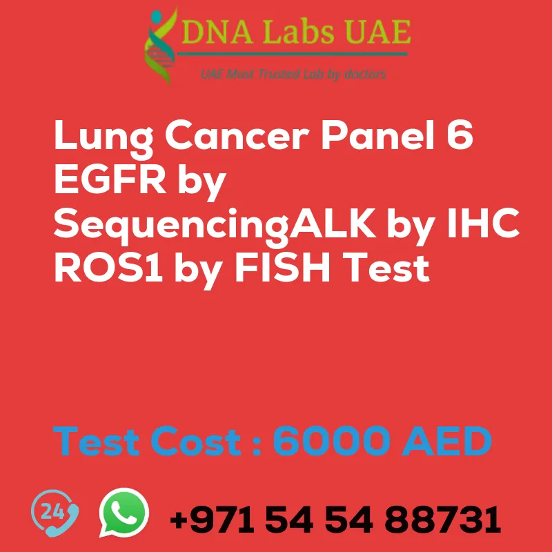 Lung Cancer Panel 6 EGFR by SequencingALK by IHC ROS1 by FISH Test sale cost 6000 AED