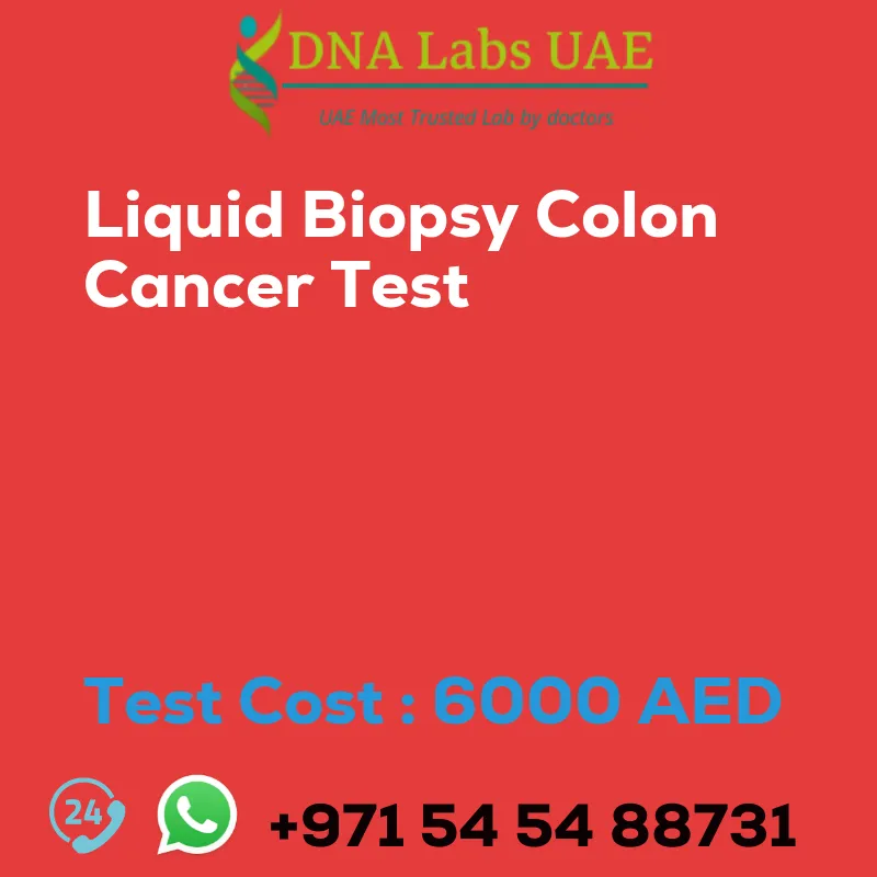 Liquid Biopsy Colon Cancer Test sale cost 6000 AED