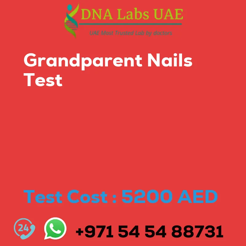 Grandparent Nails Test sale cost 5200 AED