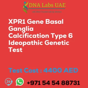 XPR1 Gene Basal Ganglia Calcification Type 6 Ideopathic Genetic Test sale cost 4400 AED
