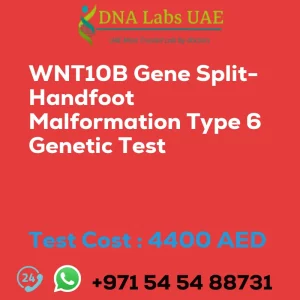 WNT10B Gene Split-Handfoot Malformation Type 6 Genetic Test sale cost 4400 AED