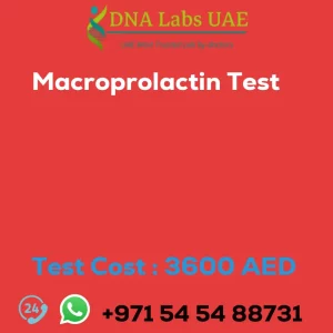 Macroprolactin Test sale cost 3600 AED