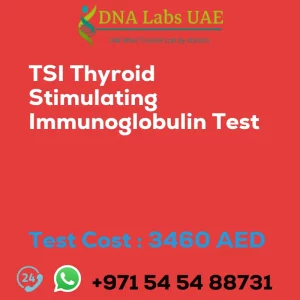 TSI Thyroid Stimulating Immunoglobulin Test sale cost 3460 AED