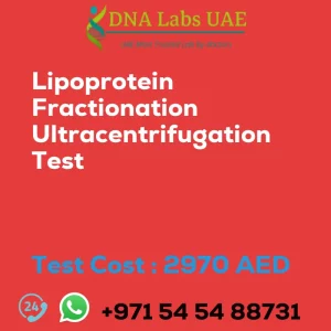 Lipoprotein Fractionation Ultracentrifugation Test sale cost 2970 AED