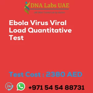 Ebola Virus Viral Load Quantitative Test sale cost 2380 AED