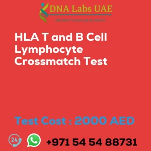HLA T and B Cell Lymphocyte Crossmatch Test sale cost 2000 AED