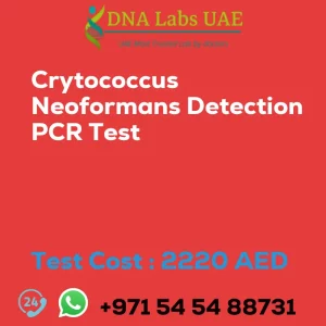 Crytococcus Neoformans Detection PCR Test sale cost 2220 AED