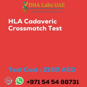 HLA Cadaveric Crossmatch Test sale cost 2180 AED