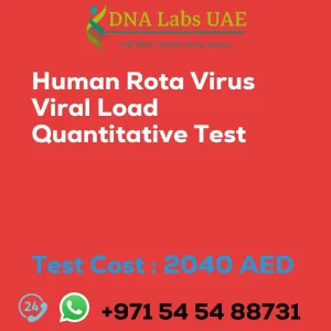 Human Rota Virus Viral Load Quantitative Test sale cost 2040 AED