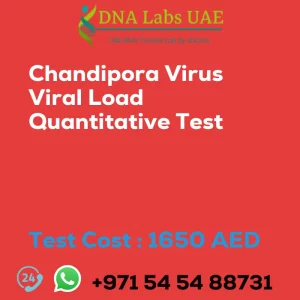 Chandipora Virus Viral Load Quantitative Test sale cost 1650 AED