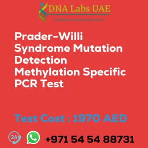 Prader-Willi Syndrome Mutation Detection Methylation Specific PCR Test sale cost 1970 AED