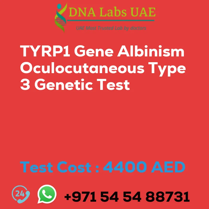 TYRP1 Gene Albinism Oculocutaneous Type 3 Genetic Test sale cost 4400 AED