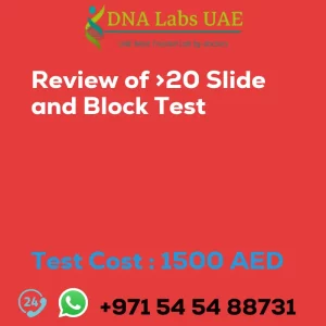 Review of >20 Slide and Block Test sale cost 1500 AED