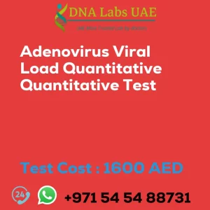Adenovirus Viral Load Quantitative Quantitative Test sale cost 1600 AED