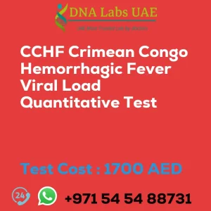 CCHF Crimean Congo Hemorrhagic Fever Viral Load Quantitative Test sale cost 1700 AED