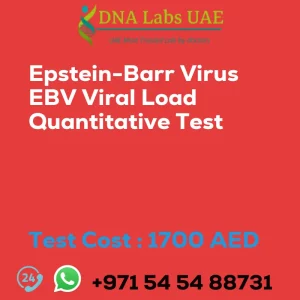 Epstein-Barr Virus EBV Viral Load Quantitative Test sale cost 1700 AED