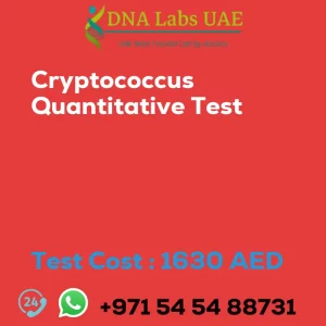 Cryptococcus Quantitative Test sale cost 1630 AED