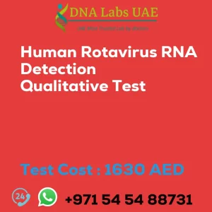 Human Rotavirus RNA Detection Qualitative Test sale cost 1630 AED