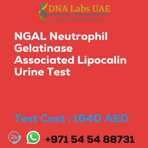 NGAL Neutrophil Gelatinase Associated Lipocalin Urine Test sale cost 1640 AED