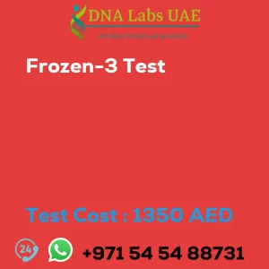 Frozen-3 Test sale cost 1350 AED