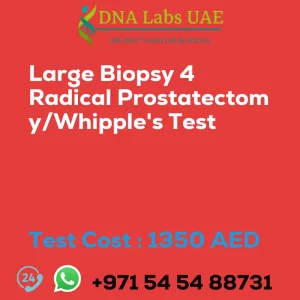 Large Biopsy 4 Radical Prostatectomy/Whipple's Test sale cost 1350 AED