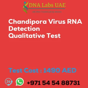 Chandipora Virus RNA Detection Qualitative Test sale cost 1490 AED