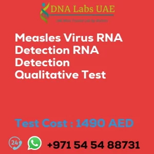 Measles Virus RNA Detection RNA Detection Qualitative Test sale cost 1490 AED