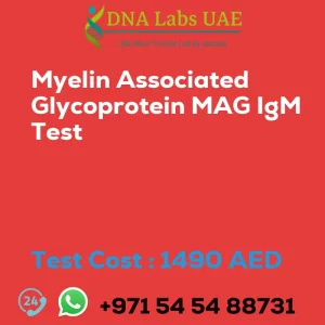 Myelin Associated Glycoprotein MAG IgM Test sale cost 1490 AED