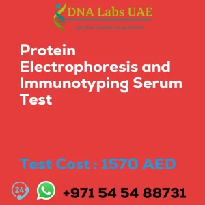 Protein Electrophoresis and Immunotyping Serum Test sale cost 1570 AED