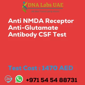 Anti NMDA Receptor Anti-Glutamate Antibody CSF Test sale cost 1470 AED