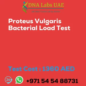 Proteus Vulgaris Bacterial Load Test sale cost 1360 AED