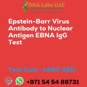 Epstein-Barr Virus Antibody to Nuclear Antigen EBNA IgG Test sale cost 1400 AED