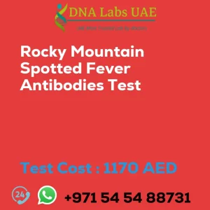 Rocky Mountain Spotted Fever Antibodies Test sale cost 1170 AED