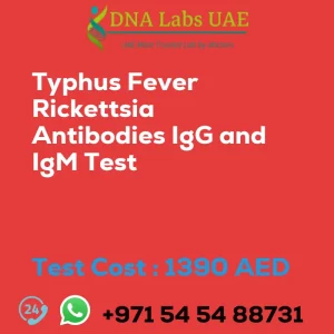 Typhus Fever Rickettsia Antibodies IgG and IgM Test sale cost 1390 AED