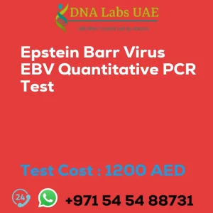 Epstein Barr Virus EBV Quantitative PCR Test sale cost 1200 AED