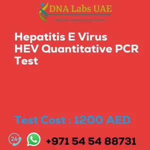 Hepatitis E Virus HEV Quantitative PCR Test sale cost 1200 AED