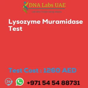 Lysozyme Muramidase Test sale cost 1260 AED