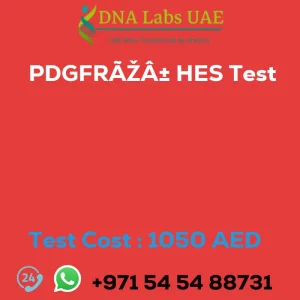 PDGFRÃŽÂ± HES Test sale cost 1050 AED