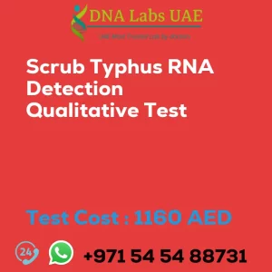 Scrub Typhus RNA Detection Qualitative Test sale cost 1160 AED