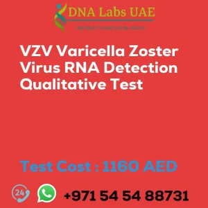 VZV Varicella Zoster Virus RNA Detection Qualitative Test sale cost 1160 AED