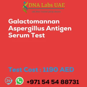 Galactomannan Aspergillus Antigen Serum Test sale cost 1190 AED